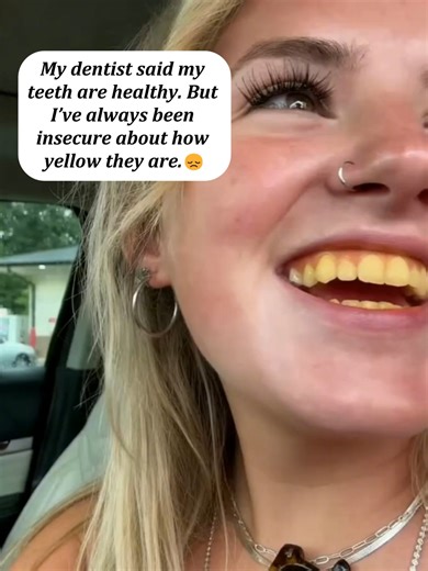 Effective Solutions for Yellow Teeth