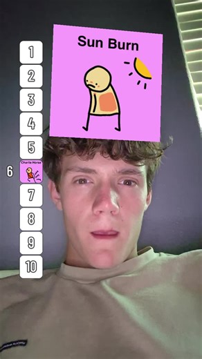 Sunburn Woes: A Painful Experience