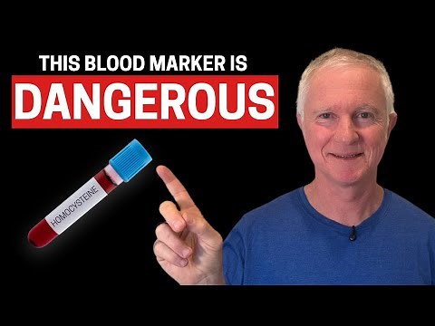 Why Your Homocysteine Is High (Even If You Take B Vitamins!)