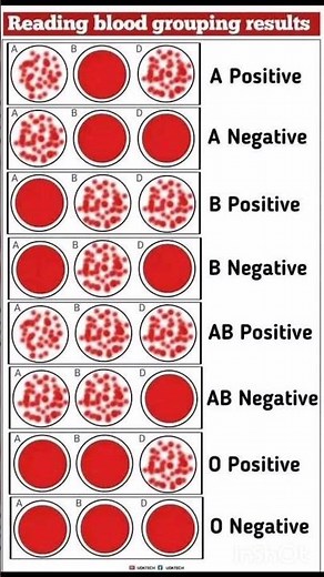 🩸 Blood Grouping Explained | Types, Rh Factor & Compatibility