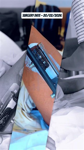 Limb Lengthening Discrepancy | Height Increase Surgery | Limb Lengthening Surgery in India