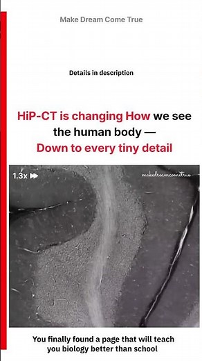 🧠HiP-CT is changing How 🔍 we see the human body 🧬 —Down to every tiny detail 🧑‍⚕️ | MDCT