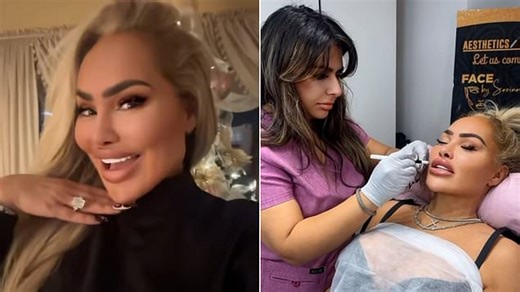 90 Day Fiancé star Darcey Silva, 50, shocks fans with latest cosmetic surgery