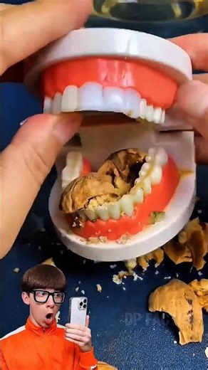 Temporary tooth repair kit