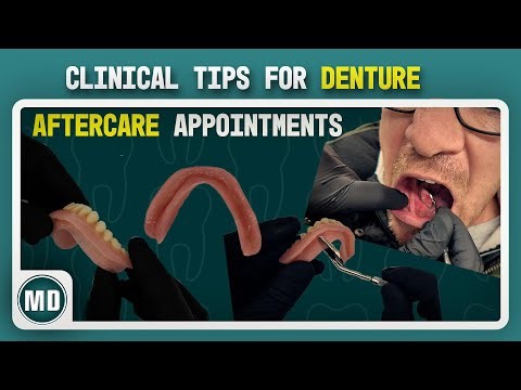 Clinical Tips for Denture Aftercare Appointments | Modern Dentures