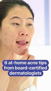 Follow these tips from board-certified dermatologists to care for your acne during treatment. | American Academy of Dermatology