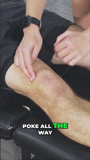 Patellofemoral Pain Syndrome Expert Shares Top Exam Secrets You Need to Know
