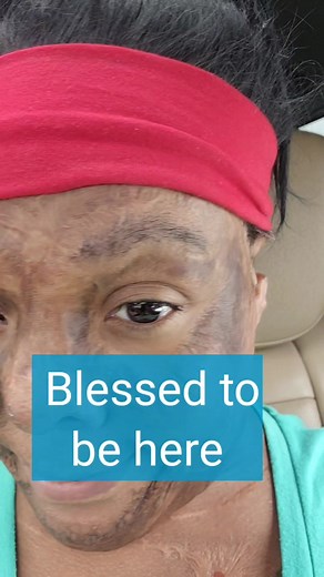 6.1K reactions · 43 shares | I'm so glad I don't have to draw my eyebrows on anymore. Shout out to NadyB Beauty Bar for my permanent ombre brows. It was an amazing experience! Follow that page for more info to book an appointment or sign up for classes! #fyp #microblading #confidence #nervous #burnsurvivor #permanentmakeup #xyzbca #viral #followers #beautiful | Mica Meek | Facebook