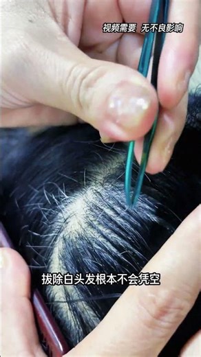 白头发会越拔越多吗 #科普 #百科密码#funny