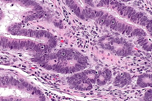 Lymphocytes and Microscopy - Staining, Observations, Discussion