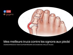 How to fix your bunions? 👣 #capsuleyogami #halluxvalgus