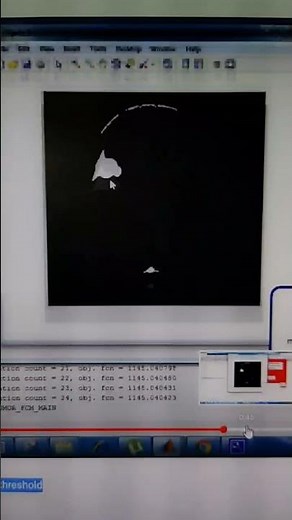 Brain tumor detection using class 3 fuzzy FCM threshold | MATLAB CODE