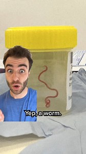 A woman in Australia had a live worm plucked from her brain after she experienced mysterious symptoms. https://nbcnews.app.link/gsH65lkuFCb | NBC News