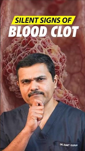 Blood Clot Warning Signs Most People Miss #Shorts