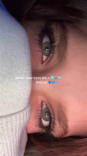 Understanding Eye Colors: Grey-Blue and Beyond