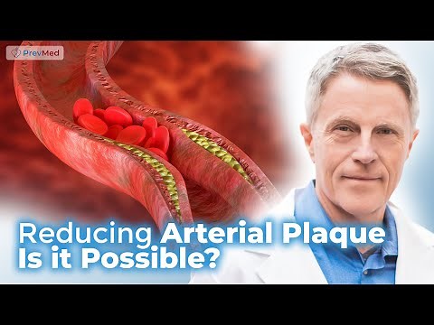 Reducing Arterial Plaque - Is it Possible?