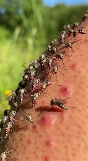 billions mosquito b-i-t-e leg