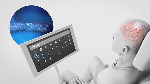 The Stentrode, implanted in the motor cortex, interprets signals from the brain