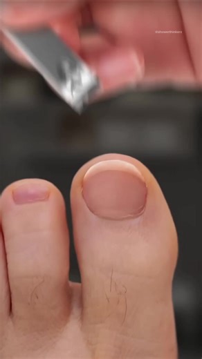 You’re Trimming Toenails Wrong | nails