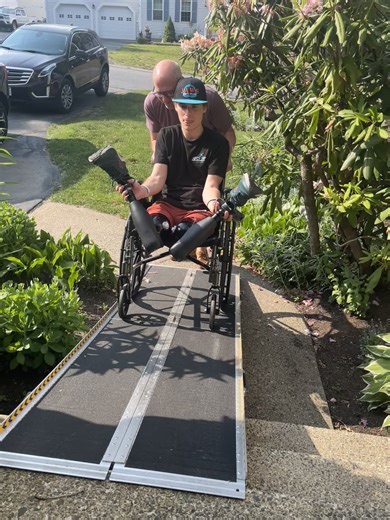 Leg Challenge: Embracing the Amputee Journey