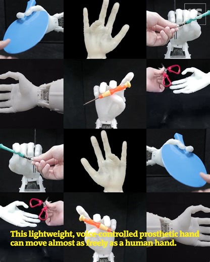 A prosthetic hand that enables people to tie knots and comb their hair also weighs about half that of a human hand. Read more: https://www.newscientist.com/article/2467328-dexterous-and-light-prosthetic-hand-can-tie-knots-and-comb-hair/ | New Scientist