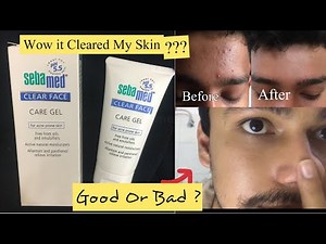 Sebamed Clear Face Care Gel Review - My Experience | Non Sponsored | Good For Acne and Oily Skin?