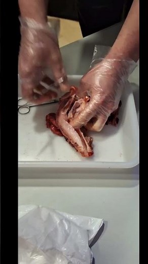 The Post-Mortem Live Human Body Dissection Experience Nottingham February 2024 #anatomy #crime #yt