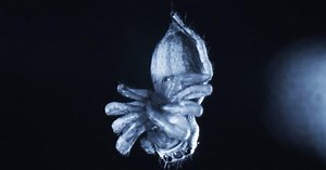 Do spiders sleep and dream like us