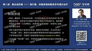 微打磨、树脂渗透和氟斑牙的漂白治疗《渗透树脂》