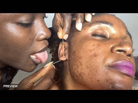 ASMR Ear Cleaning, Ear Eating, Ear Biting Scalp Scratching, Ear Licking & Hair Chewing for Sleep