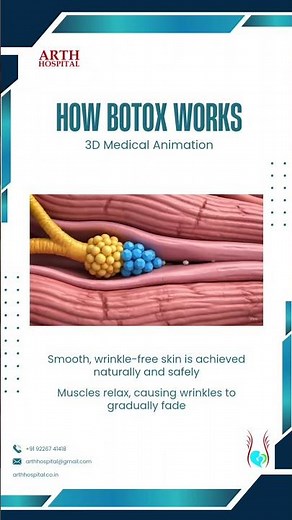 How Botox Works | 3D Medical Animation Explained #shorts