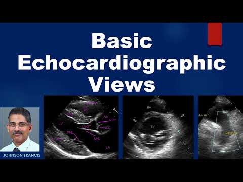 Basic Echocardiographic Views