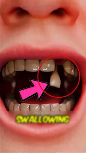 What Happens If You Swallow a Tooth #shorts #HealthFacts #didyouknow