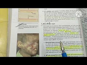 DNA Repair Genetics/ Lippincott Biochemistry