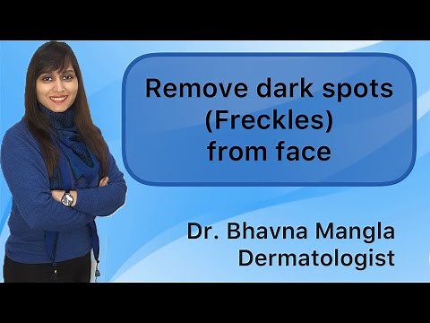 How to Get Rid of Freckles or Brown Spots | Freckles | Dark Brown Spots