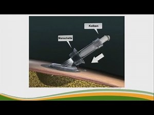 Schritt 4: Den Sensor des Dexcom G4 Platinum-Systems richtig setzen