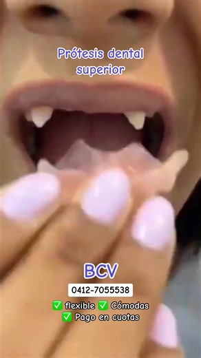 🚨Paga al BCV #paratii #cariesdental #venezuela🇻🇪 #caracas #odontologiacaracas