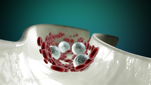 Immune Cells Found to Drive Complex Symptoms of Systemic Sclerosis | Immunology