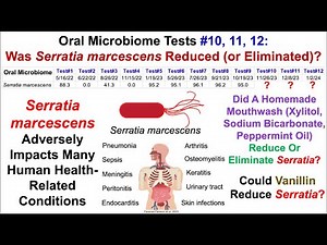 Oral Microbiome Tests #10, 11, 12: Any Luck With Reducing Or Eliminating Serratia marcescens?