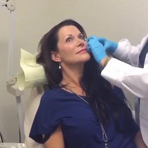 How to get rid of Crow’s Feet!