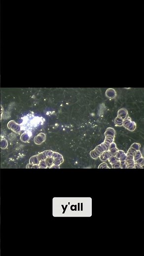 Live Blood Under Microscope: See Your Red Blood Cells NOW!