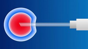 Download In Vitro Fertilization Process - Medical Animation for free