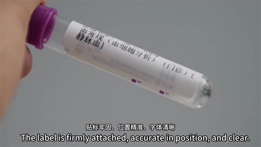 💡 Lab Pros, This Blood Tube Labeler is Your Efficiency Boost! It applies labels to blood tubes with high precision and automation, speeding up lab workflows and eliminating manual labeling errors. A must for streamlined lab operations! Product Link: https://shorturl.asia/QxUjm #LabEquipment #BloodTubeLabeler #MedicalDevice #LabAutomation #ClinicalLab #HealthcareInnovation #PrecisionLabeling #LabProductivity #MedicalLab #DeviceInnovation #HealthcareProfessionals #LabEfficiency #PatientCare #Medi