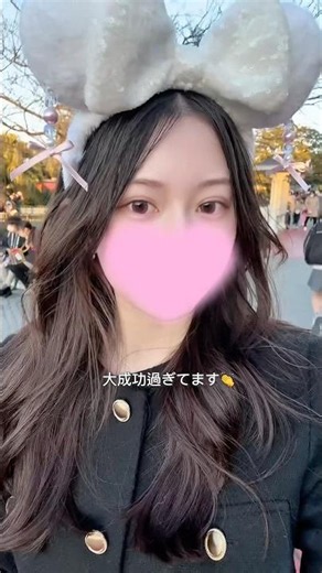 転職するので埋没してきました #埋没法 #二重整形 #二重埋没