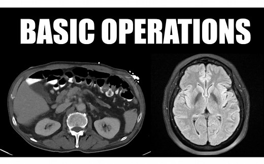 FireVoxel Tutorial 1 Basic Operations