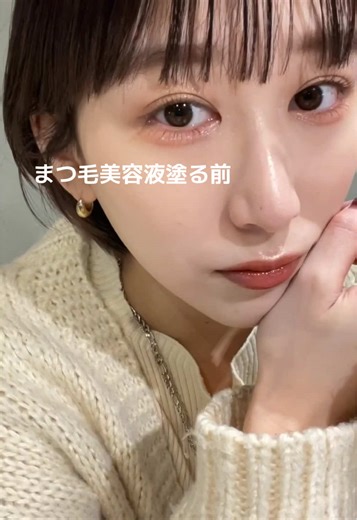 ラッシュアディクトのリアル口コミ🥹❤️ めちゃめちゃ色素沈着するけどめちゃめちゃ伸びた🌸 使い始めて一ヶ月半くらいでぐんと伸びてそこから何故かすぐに抜けてめげずに塗り続けたら三ヶ月くらいで伸び続けていまは思い出した時に塗るくらいの頻度でもかなり安定した🌿 マツパしていますがしたてでぬるとばらつきが早く気になるので２週間は空けてます💁‍♀️#まつ毛美容液 #ラッシュアディクト#まつ育