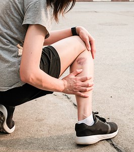 Essential Oils For Bruises: 8 Quick-Healing Oils To Try