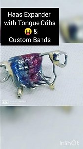 Haas Expander with Tongue Cribs 😝 & Custom Bands