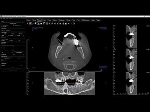 Invivo 6 - ArchSection View Tab