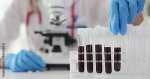 Blood samples in laboratory conditions and test tubes with blood closeup